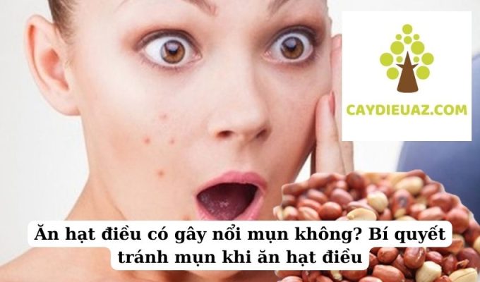 Ăn hạt điều có gây nổi mụn không Bí quyết tránh mụn khi ăn hạt điều